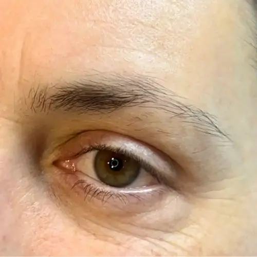 Primer plano del ojo de una persona con iris marrón, cejas naturales, ligeros pliegues en la piel y textura visible.