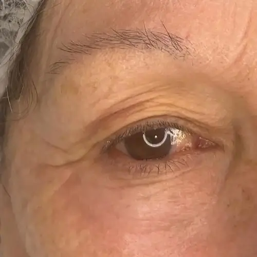 Primer plano del ojo derecho de una persona mayor que muestra arrugas y un reflejo en la pupila.