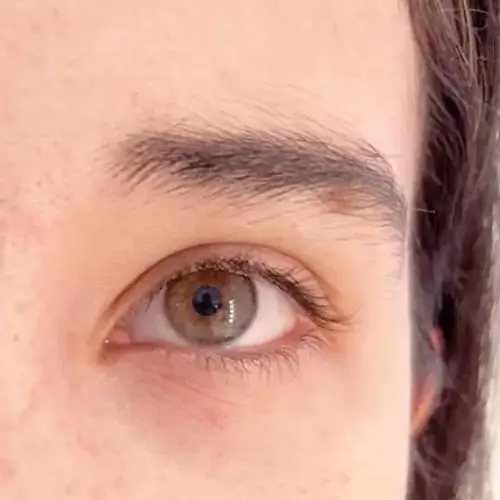 Primer plano del ojo derecho y la ceja de una persona, que muestra la textura y el detalle de la piel. El ojo está abierto y mira al frente.