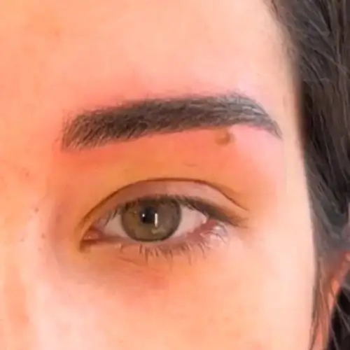 Primer plano del ojo derecho y la ceja de una persona, mostrando un ligero enrojecimiento encima del área de la ceja.