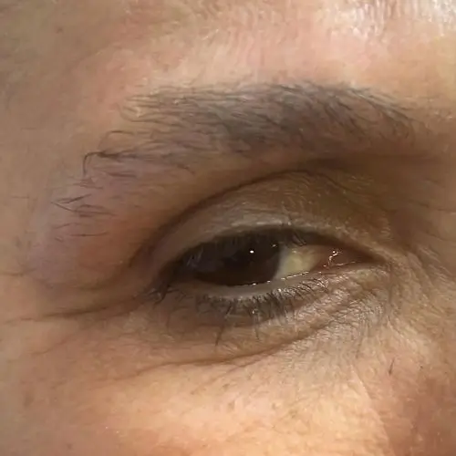 Primer plano del ojo de una persona con pestañas, cejas y textura de la piel visibles.