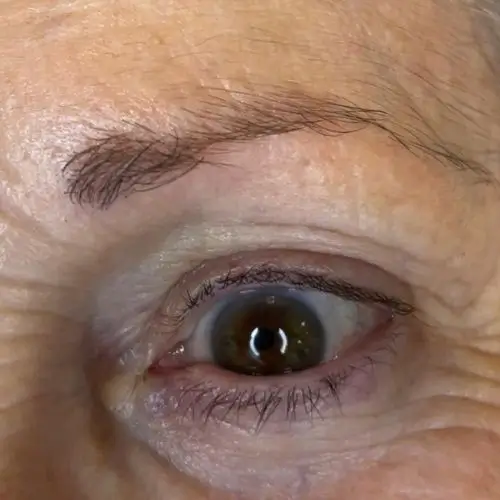 Primer plano del ojo y la ceja de una persona mayor, mostrando arrugas y líneas finas alrededor del área.
